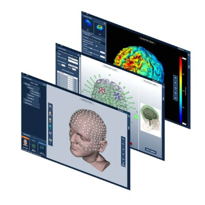 ترک اعتیاد به روش tdcs در کرج