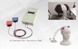 tdcs در کلینیک ترک اعتیاد ارمغان کرج